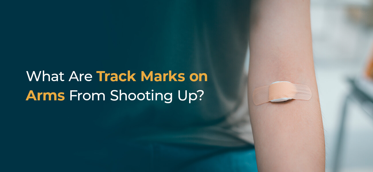 what are track marks on arms from shooting up