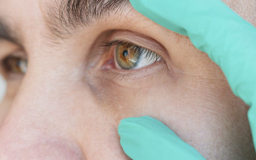 What Drugs Cause Dilated Pupils?